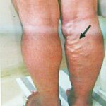 Sitting for a long time : দীর্ঘক্ষণ বসে থাকা কি আপনার পায়ের জন্য বিপজ্জনক?