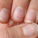 কীভাবে আপনার নখ (nails) পরিষ্কার রাখবেন: নখ এবং পায়ের নখের জন্য টিপস