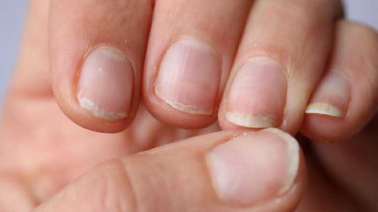 কীভাবে আপনার নখ (nails) পরিষ্কার রাখবেন: নখ এবং পায়ের নখের জন্য টিপস