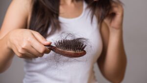 hair loss