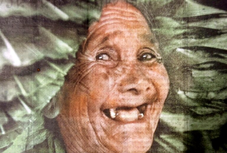 বুড়ো বয়সেও গজাবে নতুন দাঁত?