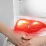 Fatty liver 1750674648701 1772465292393